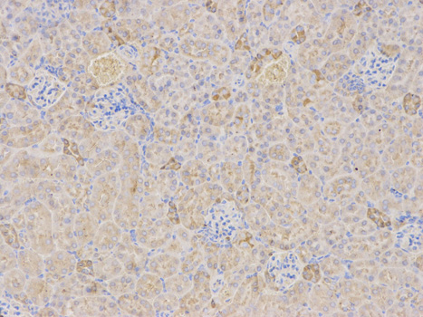 Immunohistochemistry (Formalin/PFA-fixed paraffin-embedded sections) - Anti-TFPI antibody (AB180619), expandable thumbnail