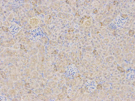 Immunohistochemistry (Formalin/PFA-fixed paraffin-embedded sections) - Anti-TFPI antibody (AB180619)
