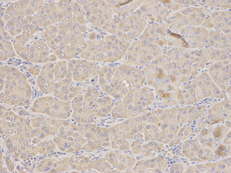 Immunohistochemistry (Formalin/PFA-fixed paraffin-embedded sections) - Anti-TFPI antibody (AB180619), expandable thumbnail