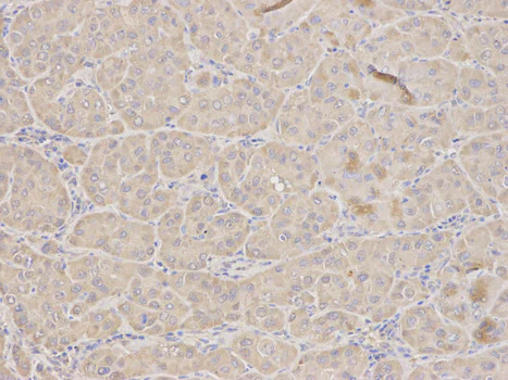 Immunohistochemistry (Formalin/PFA-fixed paraffin-embedded sections) - Anti-TFPI antibody (AB180619)
