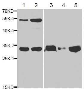 Western blot - Anti-TFPI antibody (AB180619), expandable thumbnail