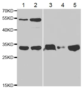 Western blot - Anti-TFPI antibody (AB180619)
