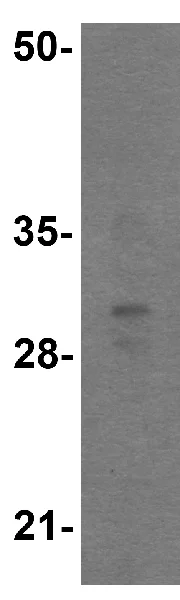 Western blot - Anti-TFPI antibody (AB181392)