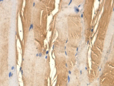 Immunohistochemistry (Formalin/PFA-fixed paraffin-embedded sections) - Anti-TFPI antibody [C1] (AB239516)
