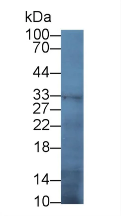 Western blot - Anti-TFPI antibody [C1] (AB239516)