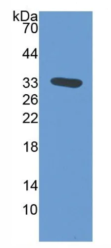 Western blot - Anti-TFPI antibody [C1] (AB239516)