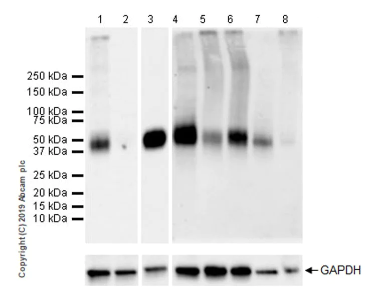 Western blot - Anti-TFPI antibody [EPR22977-133] (AB260042)