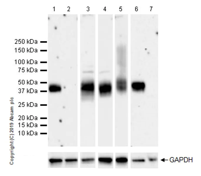 Western blot - Anti-TFPI antibody [EPR22977-16] (AB260041)