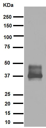 Western blot - Anti-TFPI antibody [EPR7941] (AB134151)