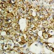 Immunohistochemistry (Formalin/PFA-fixed paraffin-embedded sections) - Anti-TFPI2 antibody (AB86933)