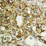 Immunohistochemistry (Formalin/PFA-fixed paraffin-embedded sections) - Anti-TFPI2 antibody (AB86933)