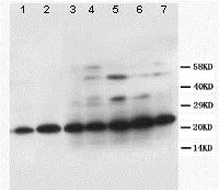 Western blot - Anti-TFPI2 antibody (AB86933)