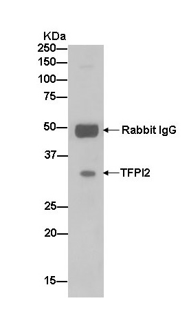 Immunoprecipitation - Anti-TFPI2 antibody [EPR14442] (AB186747), expandable thumbnail