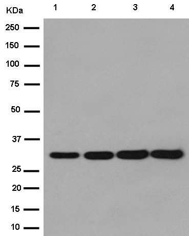 Western blot - Anti-TFPI2 antibody [EPR14442] (AB186747), expandable thumbnail