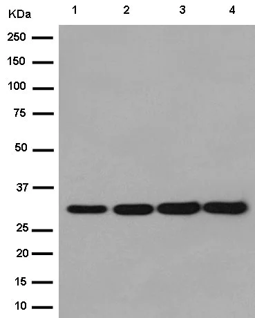Western blot - Anti-TFPI2 antibody [EPR14442] (AB186747)