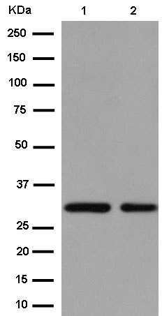 Western blot - Anti-TFPI2 antibody [EPR14442] (AB186747), expandable thumbnail