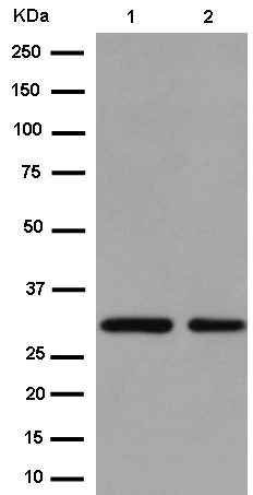 Western blot - Anti-TFPI2 antibody [EPR14442] (AB186747)