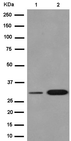 Western blot - Anti-TFPI2 antibody [EPR14442] (AB186747), expandable thumbnail