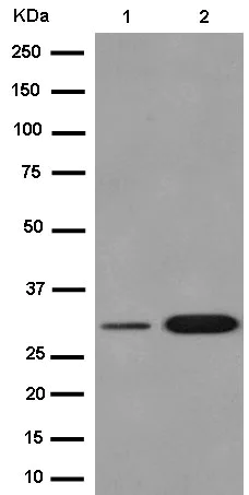 Western blot - Anti-TFPI2 antibody [EPR14442] (AB186747)