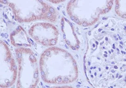 Immunohistochemistry (Formalin/PFA-fixed paraffin-embedded sections) - Anti-TFPI2 antibody [EPR14442] - BSA and Azide free (AB246362)