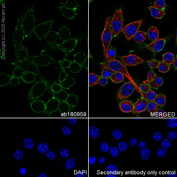 Immunocytochemistry/ Immunofluorescence - Anti-TG6 antibody [EPR10308] - BSA and Azide free (AB250287)