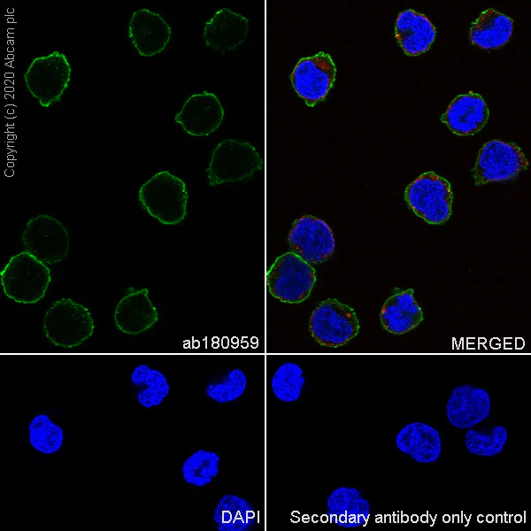 Immunocytochemistry/ Immunofluorescence - Anti-TG6 antibody [EPR10308] - BSA and Azide free (AB250287)