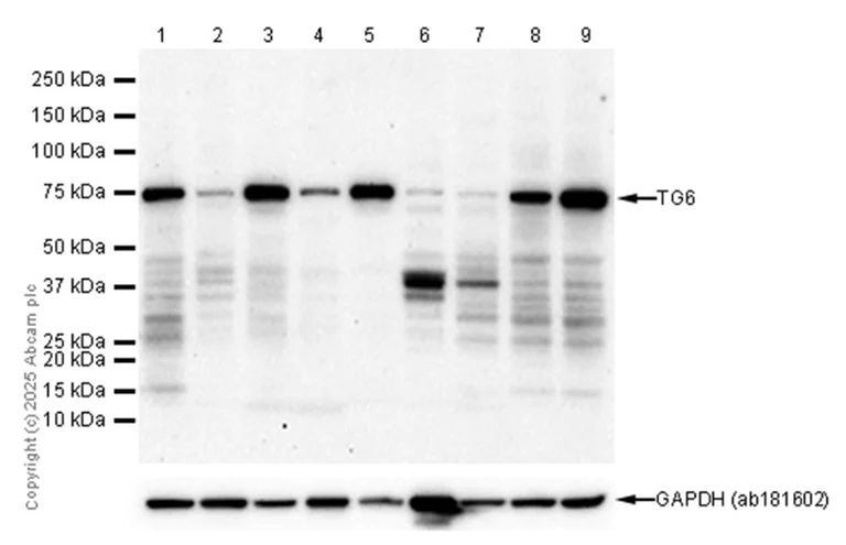 Western blot - Anti-TG6 antibody [EPR10308] - BSA and Azide free (AB250287)