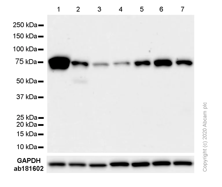 Western blot - Anti-TG6 antibody [EPR10308] - N-terminal (AB180959)