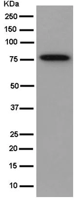 Western blot - Anti-TG6 antibody [EPR10308] - N-terminal (AB180959)