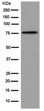 Western blot - Anti-TG6 antibody [EPR10308] - N-terminal (AB180959)