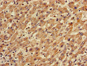 Immunohistochemistry (Formalin/PFA-fixed paraffin-embedded sections) - Anti-TGDS antibody (AB224599)