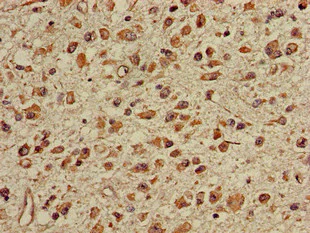 Immunohistochemistry (Formalin/PFA-fixed paraffin-embedded sections) - Anti-TGDS antibody (AB224599)