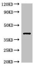 Western blot - Anti-TGDS antibody (AB224599)