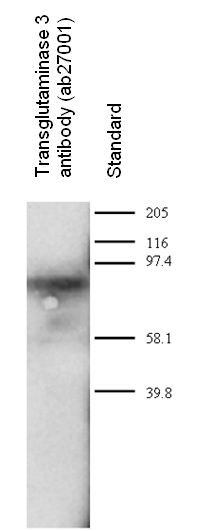 Western blot - Anti-TGE antibody (AB27001)