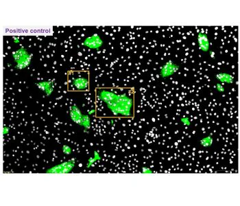 Immunocytochemistry/ Immunofluorescence - Anti-TGEV antibody [2G10] (AB325990)