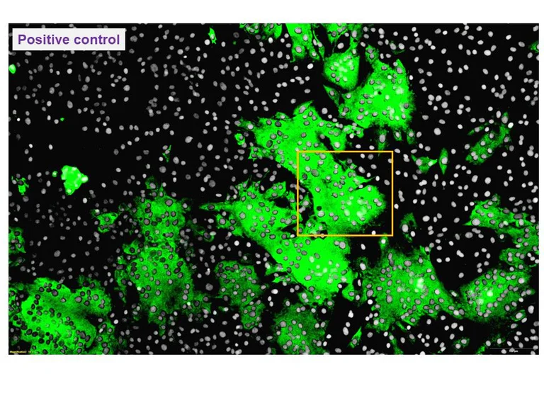 Immunocytochemistry/ Immunofluorescence - Anti-TGEV antibody [2G12] (AB325991)