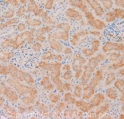 Immunohistochemistry (Formalin/PFA-fixed paraffin-embedded sections) - Anti-TGF alpha antibody (AB112030)