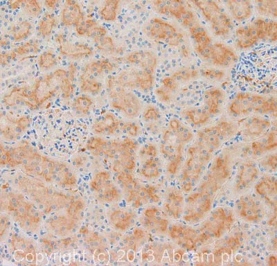 Immunohistochemistry (Formalin/PFA-fixed paraffin-embedded sections) - Anti-TGF alpha antibody (AB112030)