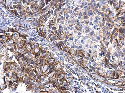 Immunohistochemistry (Formalin/PFA-fixed paraffin-embedded sections) - Anti-TGF alpha antibody (AB227723)