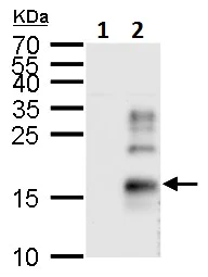 Western blot - Anti-TGF alpha antibody (AB227723)