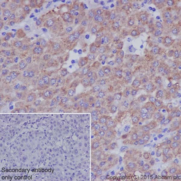 Immunohistochemistry (Formalin/PFA-fixed paraffin-embedded sections) - Anti-TGF alpha antibody [EPR15346] (AB208156)