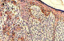 Immunohistochemistry (Formalin/PFA-fixed paraffin-embedded sections) - Anti-TGF alpha antibody [P/T1] (AB9578)
