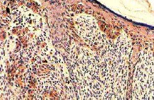 Immunohistochemistry (Formalin/PFA-fixed paraffin-embedded sections) - Anti-TGF alpha antibody [P/T1] (AB9578)