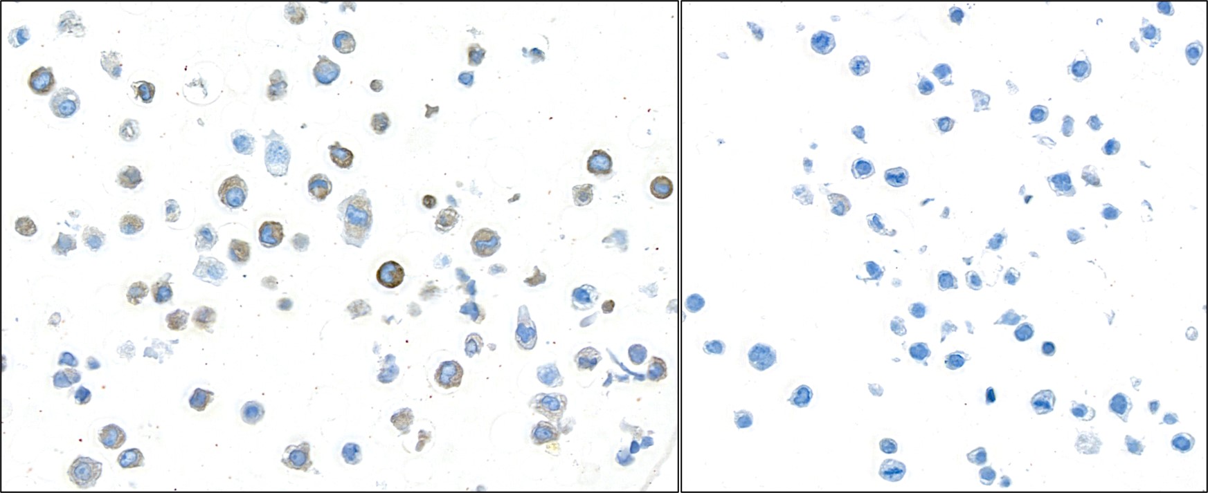 Immunocytochemistry - Anti-TGF-beta 1 antibody [BLR195J] - BSA free (AB314095), expandable thumbnail
