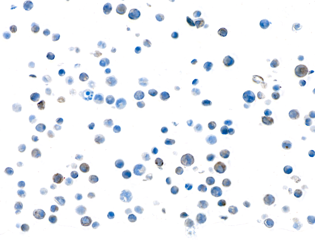 Immunocytochemistry - Anti-TGF-beta 1 antibody [BLR195J] - BSA free (AB314095), expandable thumbnail