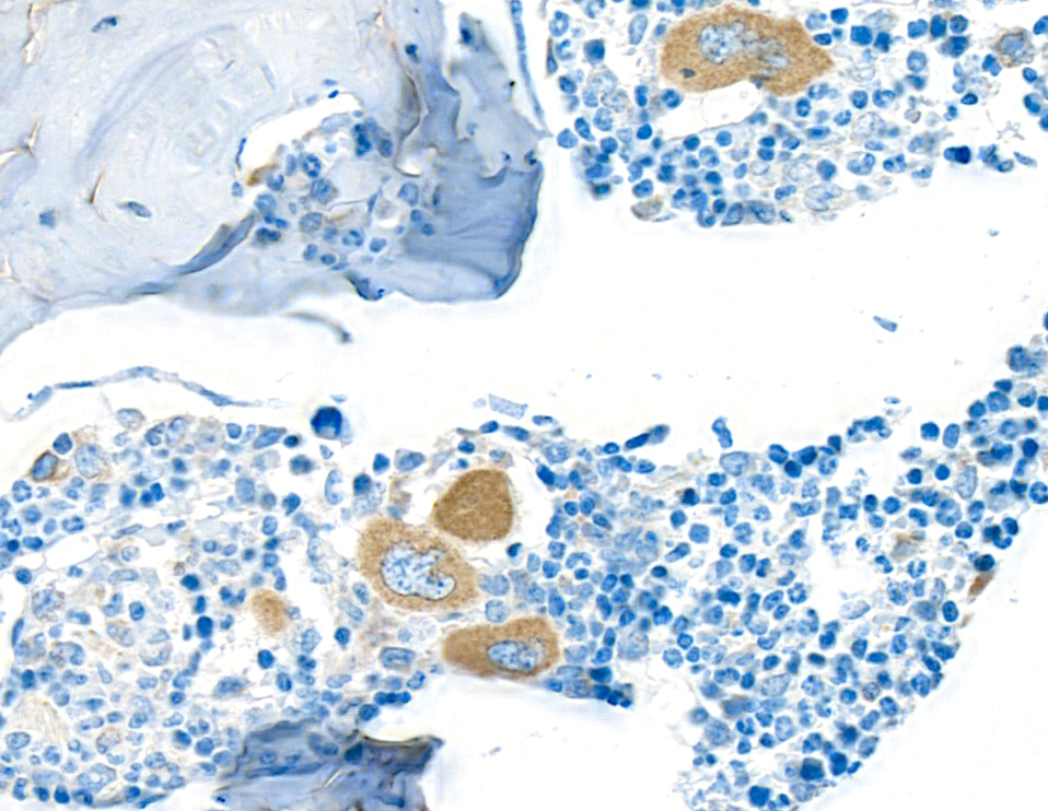 Immunohistochemistry (Formalin/PFA-fixed paraffin-embedded sections) - Anti-TGF-beta 1 antibody [BLR195J] - BSA free (ab314095), expandable thumbnail
