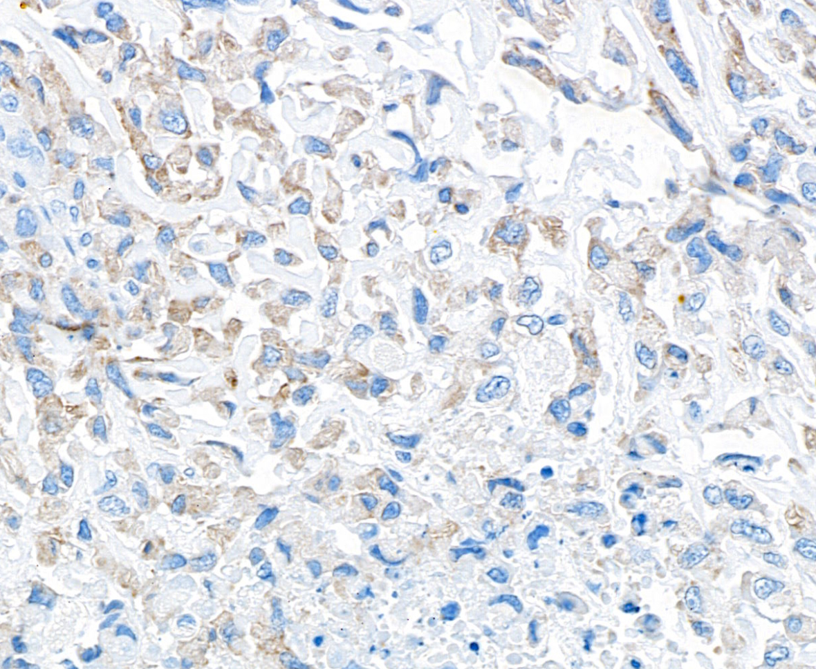 Immunohistochemistry (Formalin/PFA-fixed paraffin-embedded sections) - Anti-TGF-beta 1 antibody [BLR195J] - BSA free (ab314095), expandable thumbnail
