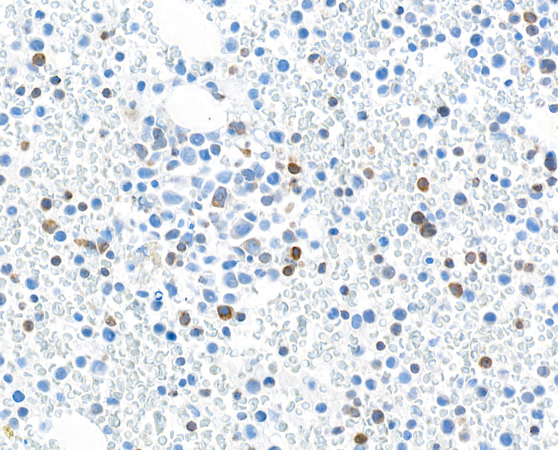 Immunohistochemistry (Formalin/PFA-fixed paraffin-embedded sections) - Anti-TGF-beta 1 antibody [BLR195J] - BSA free (ab314095), expandable thumbnail