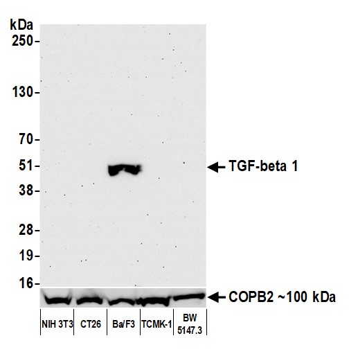 Western blot - Anti-TGF-beta 1 antibody [BLR195J] - BSA free (AB314095), expandable thumbnail