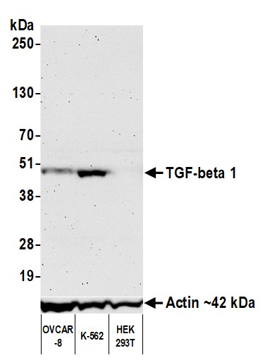 Western blot - Anti-TGF-beta 1 antibody [BLR195J] - BSA free (AB314095), expandable thumbnail